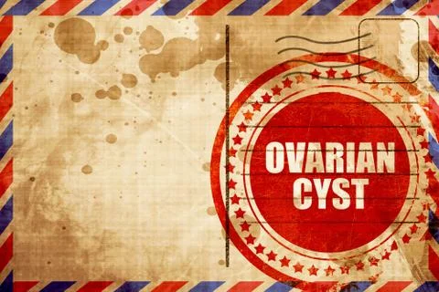 Ovarian cyst Illustrazione stock