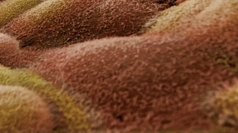 Ovarian cyst lining, SEM Vidéo 4839130