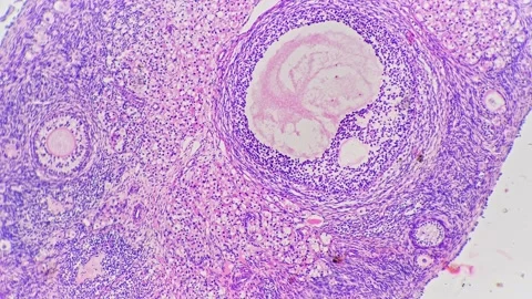 Ovary in section magnified under light micrograph 40x against bright field Stock Footage 220128063