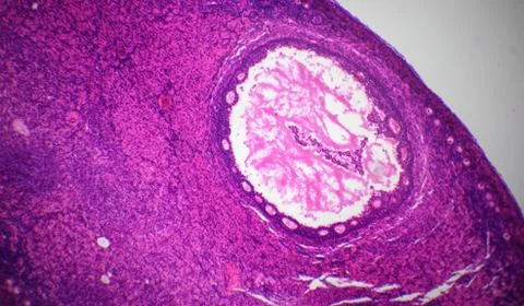 Ovary section under the microscope Stock Photos