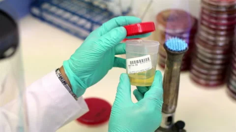 OVER SHOULDER-CLOSE UP.Laboratory worker test microorganisms into a petri dish Stock Footage 42833061
