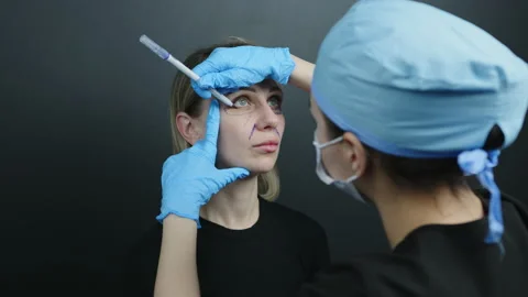 Over the shoulder shot of process of surgical marking of female face by doctor Stock Footage 239934093