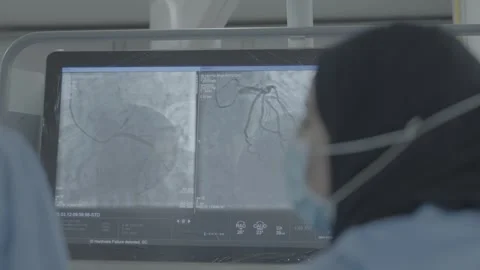 Over-the-shoulder shot of surgeons analyzing cardiac imaging Vídeo Stock 327595350