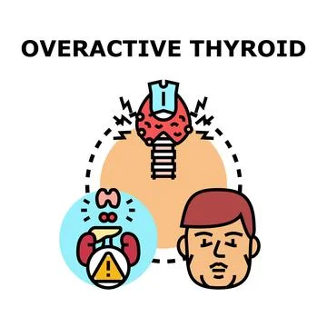 Overactive thyroid gland causing health problems Illustration