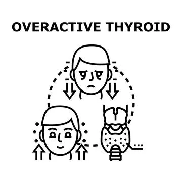 Overactive thyroid gland impacting human health Stock Illustration