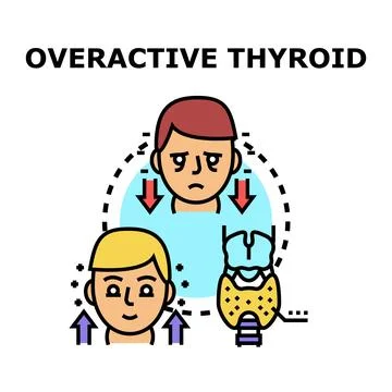Overactive thyroid gland impacting human health イラスト素材