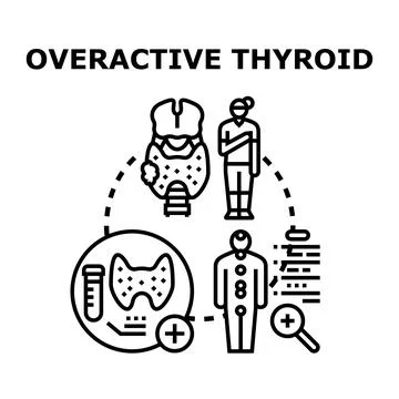 Overactive thyroid gland medical condition diagnosing and treatment Stock Illustration