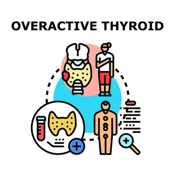 Overactive thyroid gland medical condition diagnosing and treatment Stock Illustration