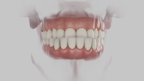 Overjet Aligner 動画素材 317187667