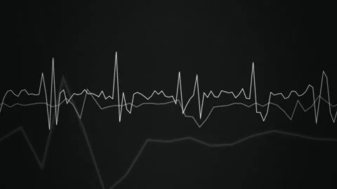 Overlapping jagged line graphs scroll in a seamless loop Stock Footage 342949260
