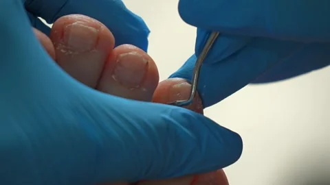 Overview of essential procedures for professional foot care and nail treatment Stock Footage 311993145
