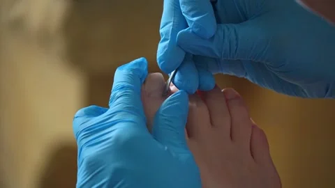 Overview of essential procedures for professional foot care and nail treatment 库存影片 311993206