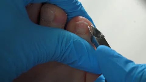 Overview of essential procedures for professional foot care and nail treatment 库存影片 311993216