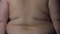 Overweight male body on black background, stretch marks and cellulite, obesity HD Footage