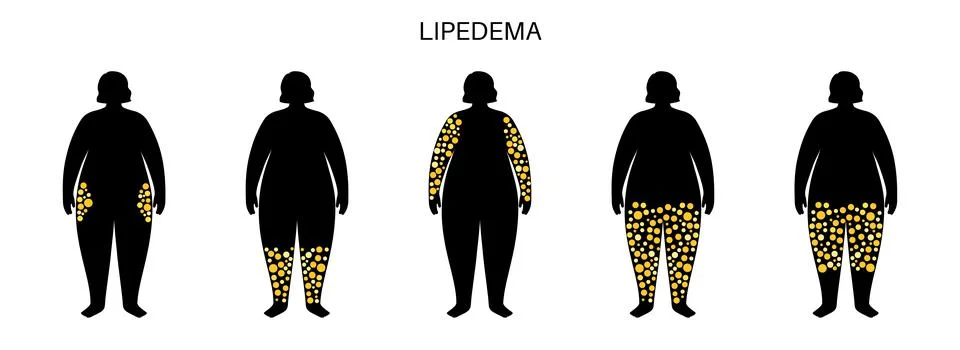 Overweight problem concept Stock Illustration