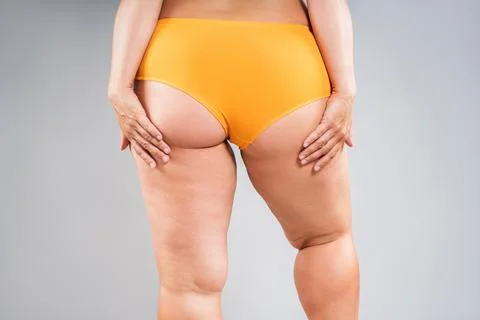 Overweight thigh, woman with fat hips and buttocks, obesity female body  with cellulite on gray background Stock Photo