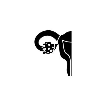 Ovulatory dysfunction icon. Simple gynaecology icons for ui and ux, website or Stock Illustration