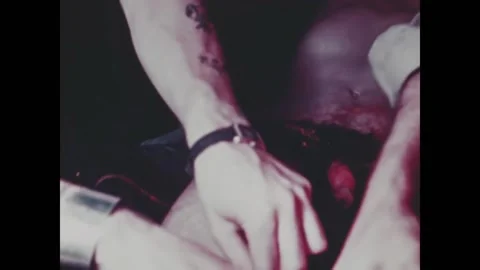 PACIFIC OCEAN - 1944 - A serviceman with an open wound starts receiving a blood 스톡 동영상 331213652