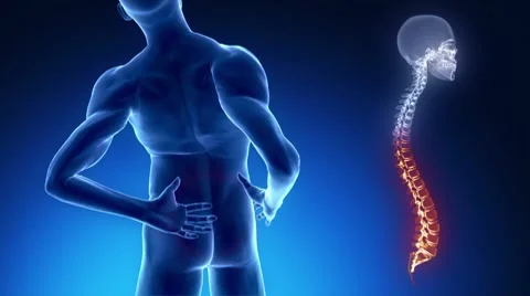 Pain in backbone concept Stock Footage