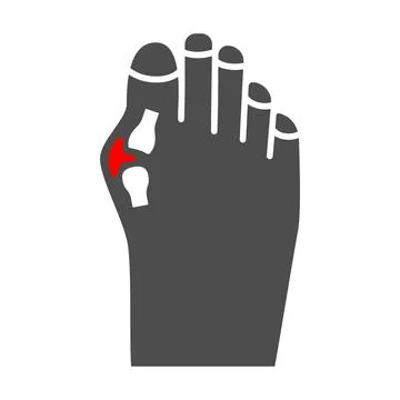 Pain in big toe joint solid icon, body pain concept, bunion vector sign on white Stock Illustration