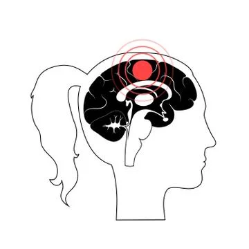 Pain Brain Illustration Ilustración de archivo