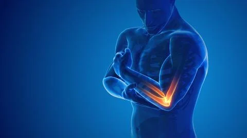 Pain in the elbow joint 库存插图