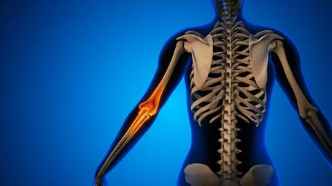 Pain in the elbow joint Stock Illustration