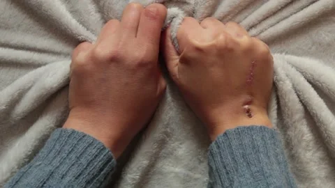 Pain Stock Footage 142167106