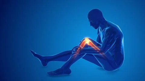 Pain in the knee joint イラスト素材