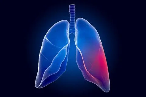 Pain in Lungs concept. Ghost light effect, x-ray hologram. 3D rendering Illustrazione stock