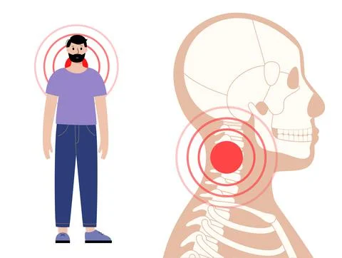 Pain in neck Stock Illustration