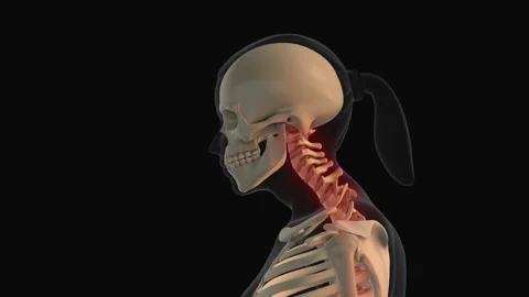 Pain in the neck or cervical postural syndrome Stock Footage 260926758