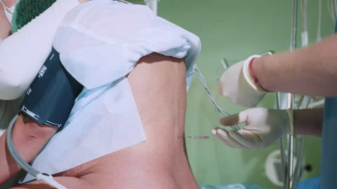 Pain relief in preparation for surgery. Spinal anesthesia injection, epidural Stock Footage 254345331