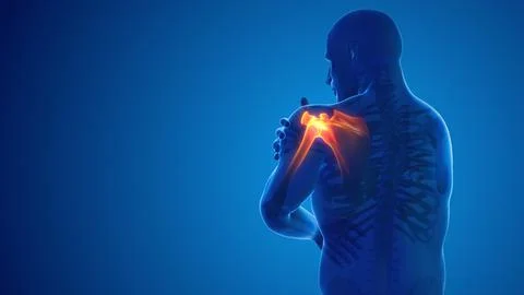 Pain in the shoulder joint Ilustración de archivo