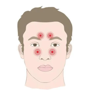 Pain sinus Stock Illustration