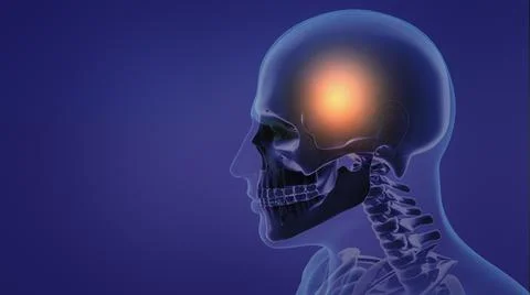 Painful Headache 库存插图