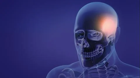 Painful Headache Illustrazione stock