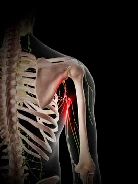 Painful human lymph nodes Stock Illustration
