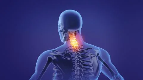 Painful neck Illustrazione stock