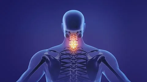 Painful neck Ilustración de archivo