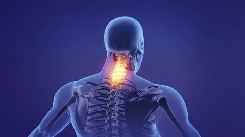 Painful neck Illustration