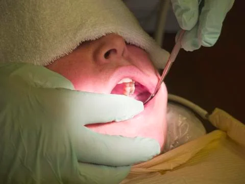 Painful procedure Fotos Stock
