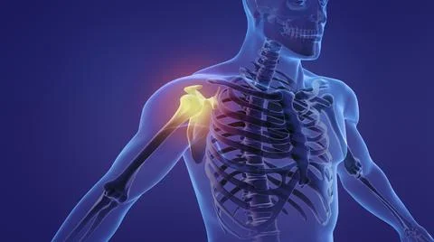 Painful shoulder Illustration