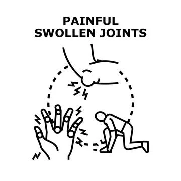 Painful swollen joints causing movement problems and discomfort 库存插图