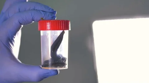 A pair of leeches inside a plastic jar. Vidéo 79036109