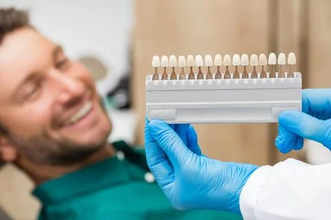 Palette tooth color sample to determine shade over patient's teeth. Stomatolo Stock Photos