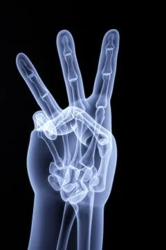 Palm Stock Illustration