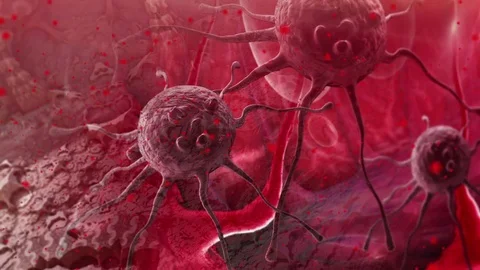 Pan and zoom camera - cancer cells with high details. Stock Footage 74183115