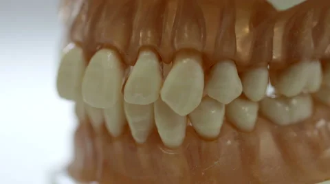 Pan on to dental model of a set of teeth in a Dentists Video stock 66543786