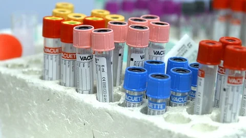PAN Medical samples in test tubes, panning from left to right Video stock 95599546